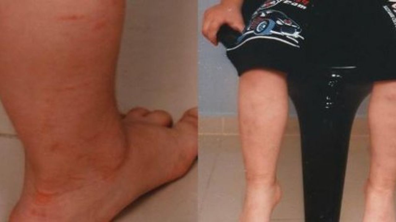 Şok olay: Torununun cinsel organına çakmaklı işkenceye isyan ettiren ceza!