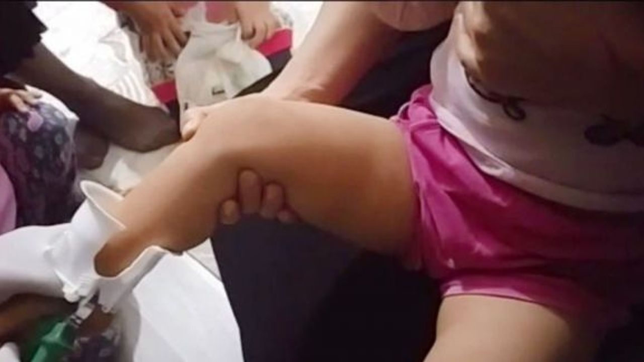 Çocuğun ayağına sıkışan tuvalet kapağı itfaiye tarafından çıkarıldı