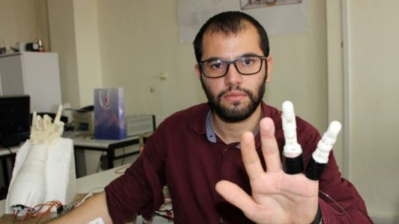 İki parmağını kaybeden mühendislik öğrencisi, kendine protez parmak yaptı