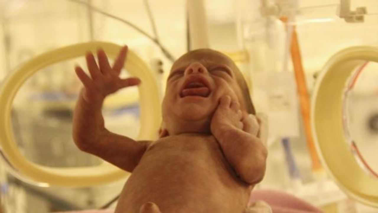 Suriye’de doğan dördüzler Türkiye’de yaşama tutundu