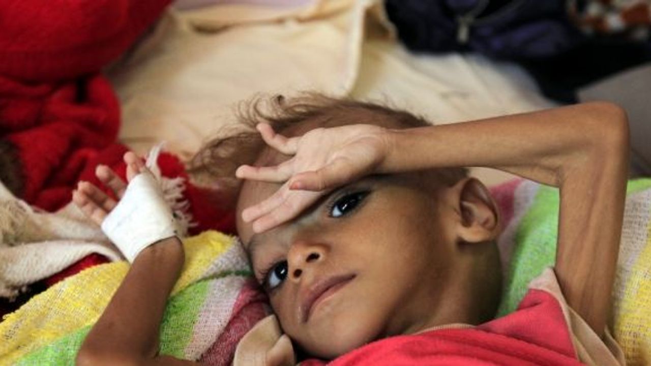 Yemenli çocuklar hayatta kalmak için üzüm yaprağı yiyor