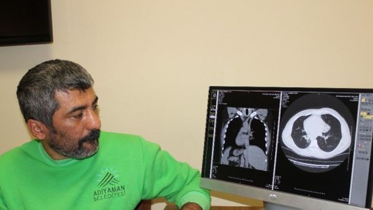 Organları ters tarafta olan adam duyanları şaşırtıyor