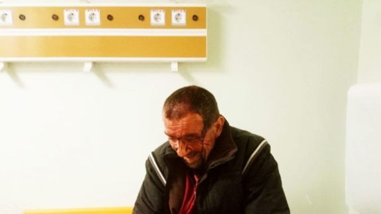 Çıkan kavgada zihinsel engelli şahsı kafasından odunla yaraladılar