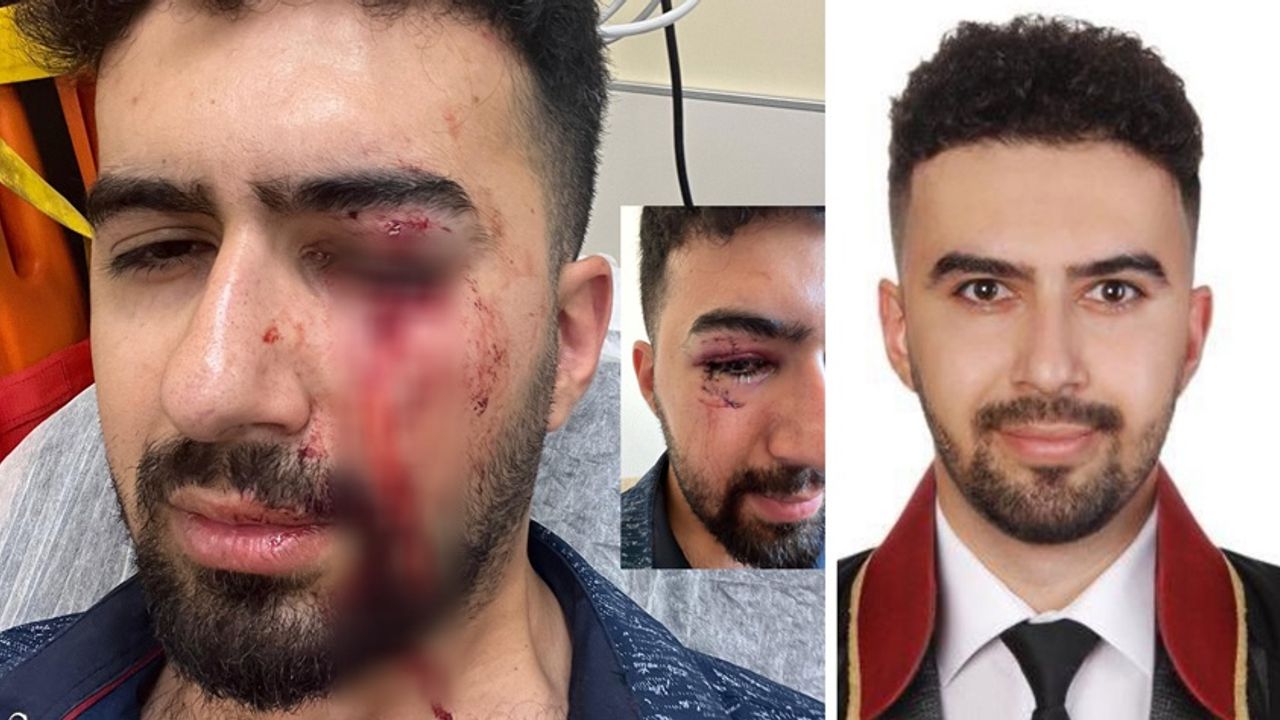 Avukata saldırı: Yüzüne 14 dikiş atıldı!
