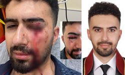 Avukata saldırı: Yüzüne 14 dikiş atıldı!