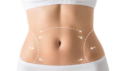 Liposuction Sonrası Çökme ve Asimetri Malpraktis Mi? Komplikasyon Nerede Biter, Hekim Sorumluluğu Nerede Başlar?