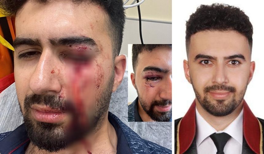 Avukata saldırı: Yüzüne 14 dikiş atıldı!